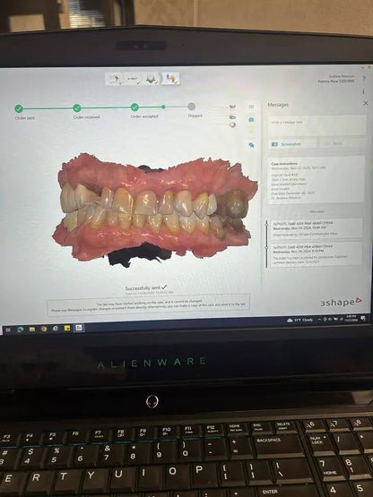 3 Shape Trios Color 3 Pod Dental Intraoral Scanner for CADCAM Dentistry